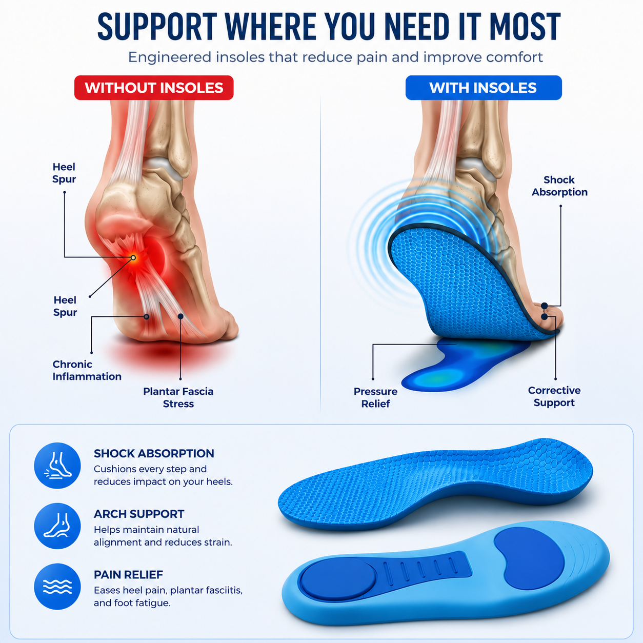 Arch Support Insoles