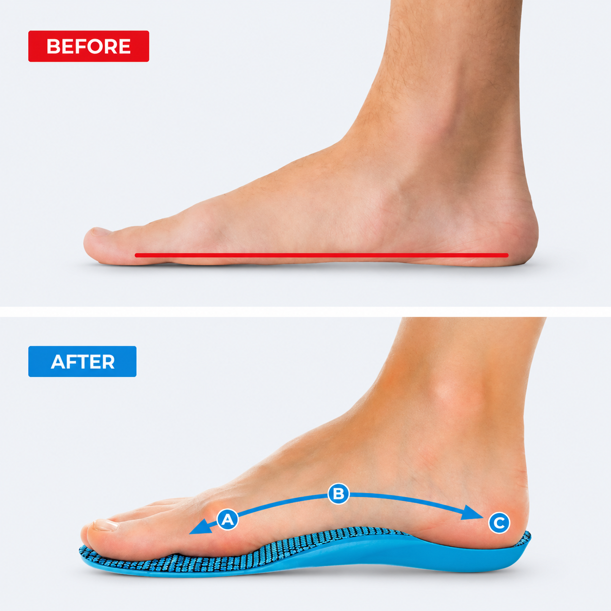 Arch Support Insoles