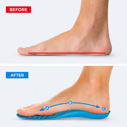 Arch Support Insoles